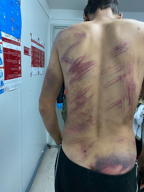 A migrant after attempting to cross the border: There have been thousands of reports of violence at the border.